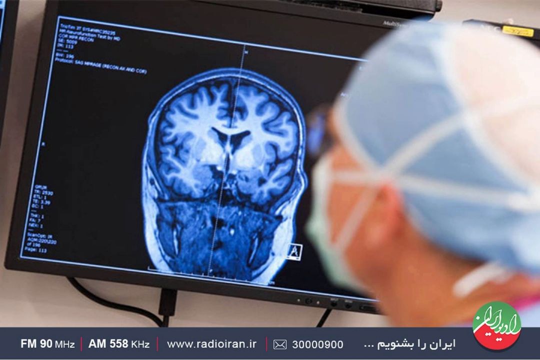 در مقابله با بیماری صرع، میزان آگاهی را باید افزایش داد