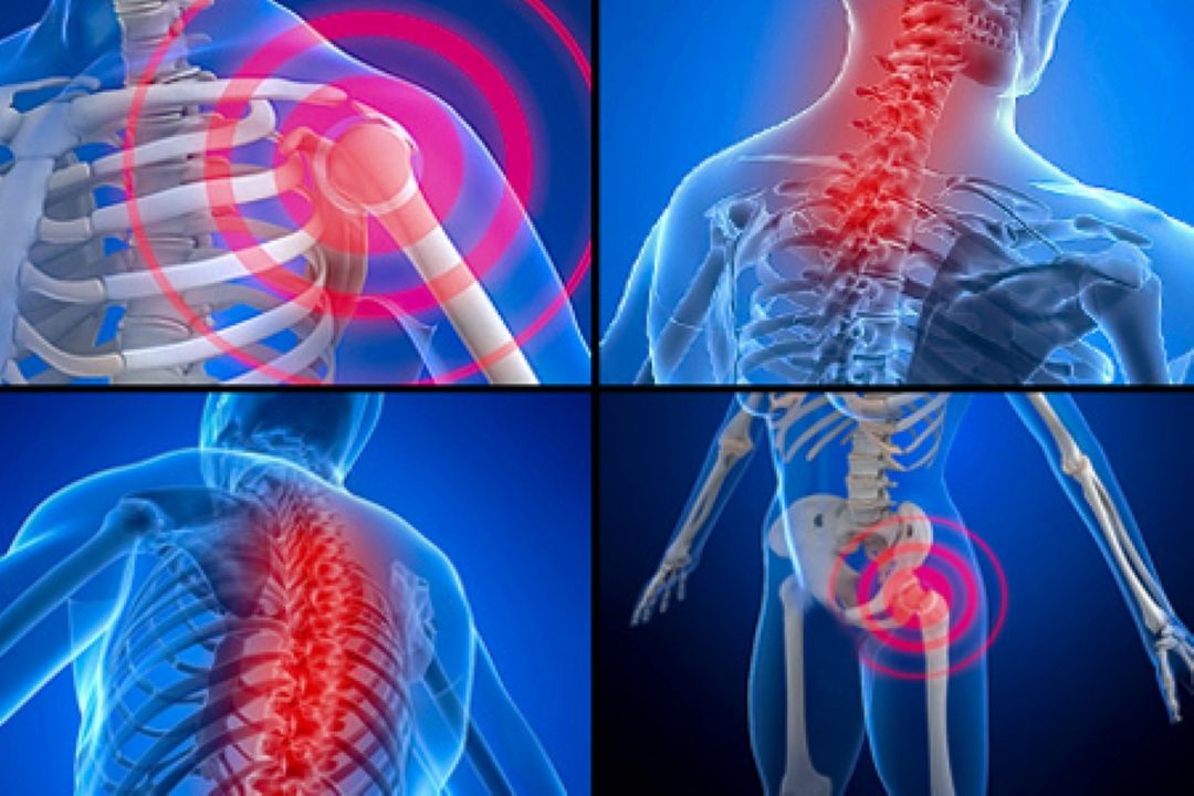 علل اختلالات اسكلتی عضلانی چیست؟ 