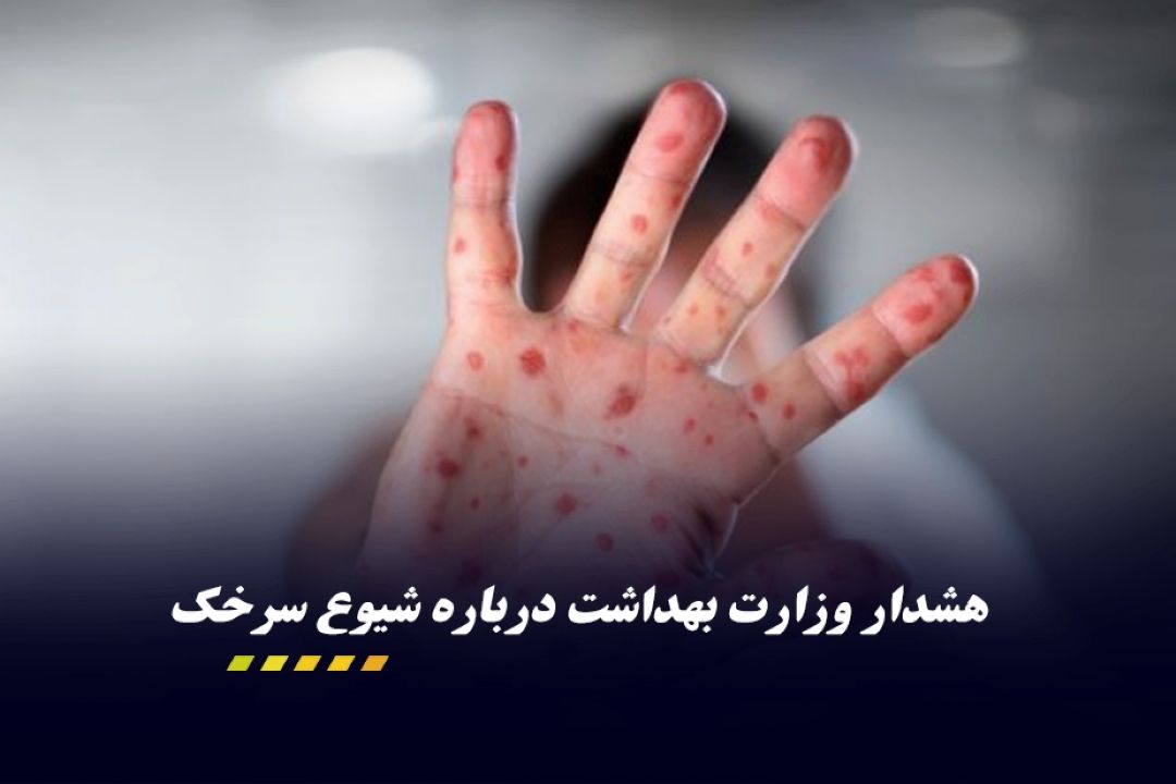 فراخوان واكسیناسیون كودكان ایرانی و مهاجر زیر 5 سال