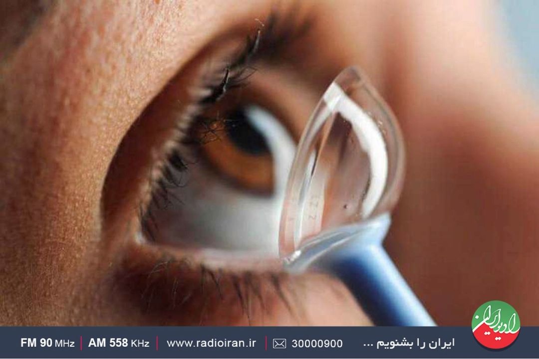 قوز قرنیه بیماری نه چندان شایع اما بسیار مهم