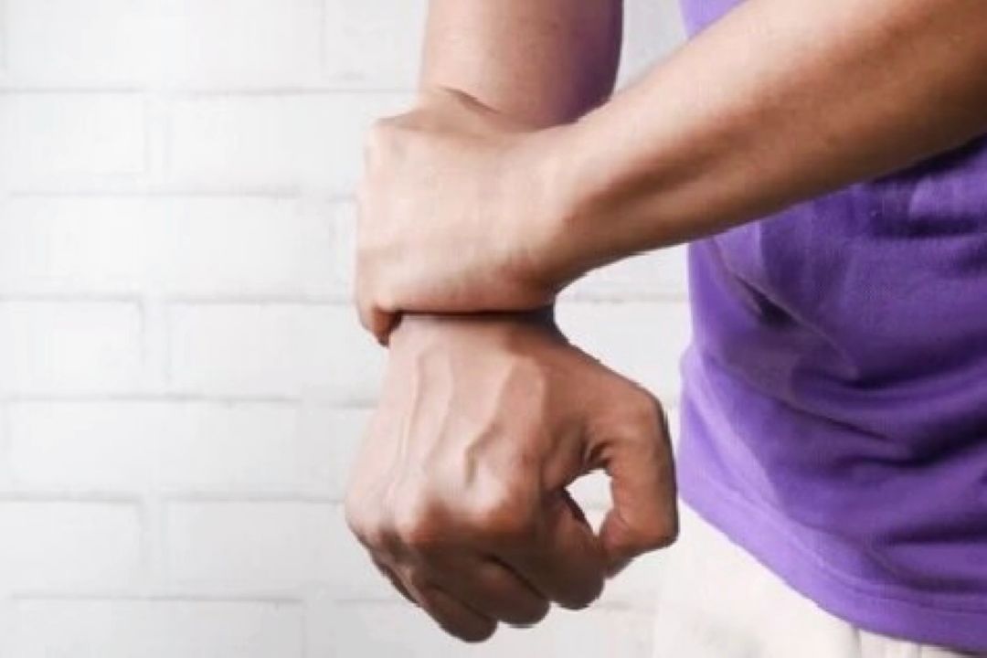 علائم اولیه آرتریت روماتوئید