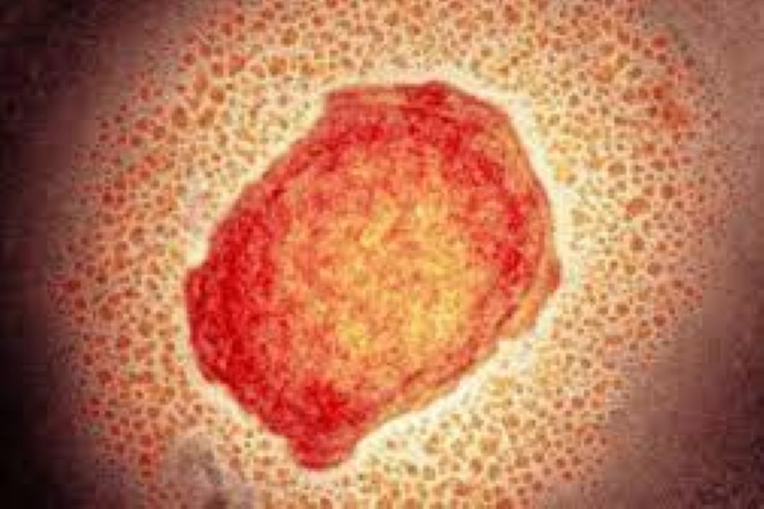  میزان شیوع و كُشندگی ویروس  آبله میمون 