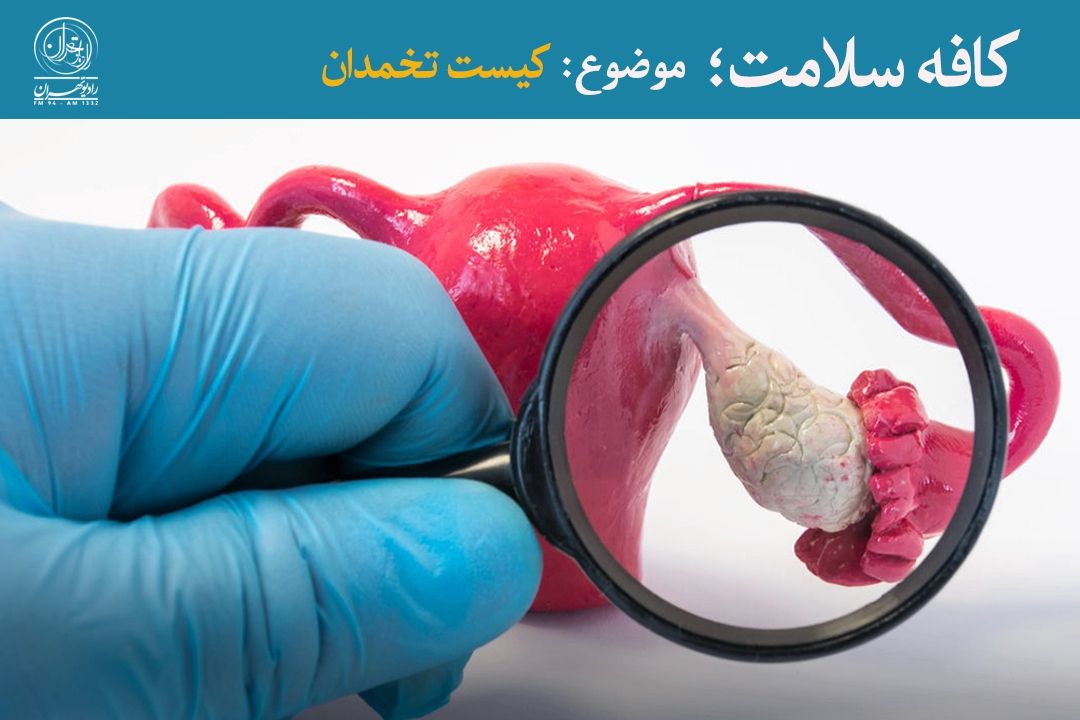 بیش از 95 درصد كیست‌های تخمدان، خوش‌خیم هستند