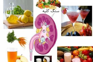 توصیه های تغذیه ای برای پیشگیری از تشكیل سنگ كلیه