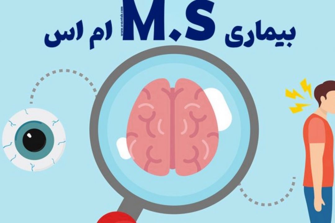 علائم بیاری ام اس