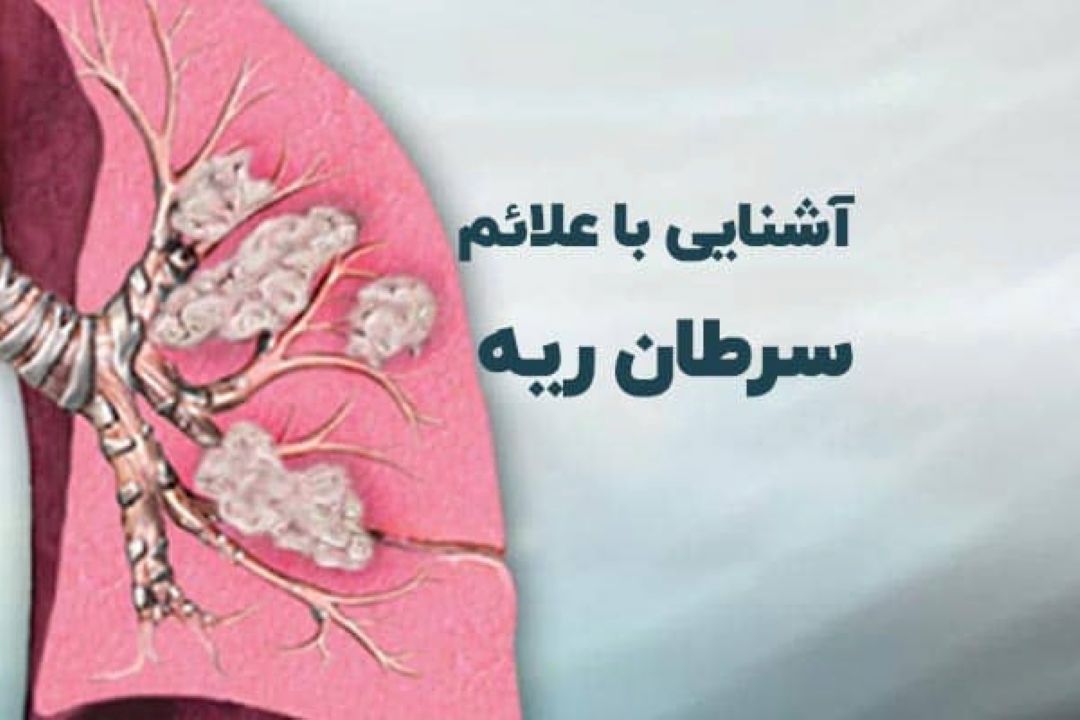 فوق تخصص بیماری‌های ریه: سرطان ریه قابل پیشگیری است