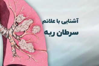 فوق تخصص بیماری‌های ریه: سرطان ریه قابل پیشگیری است