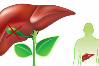 در «استودیو سلامت» بررسی می شود؛ علل بروز كیسه صفرا و راههای پیشگیری و درمان