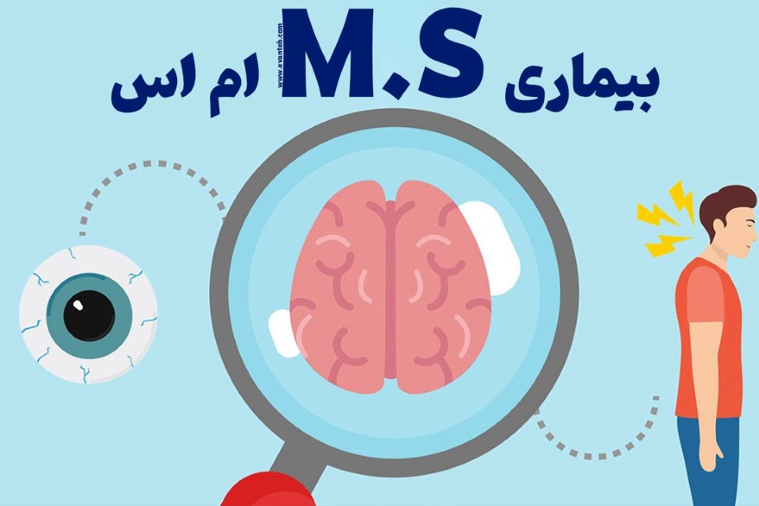 درباره‌ی بیماری ام‌ اس بیشتر بدانید
