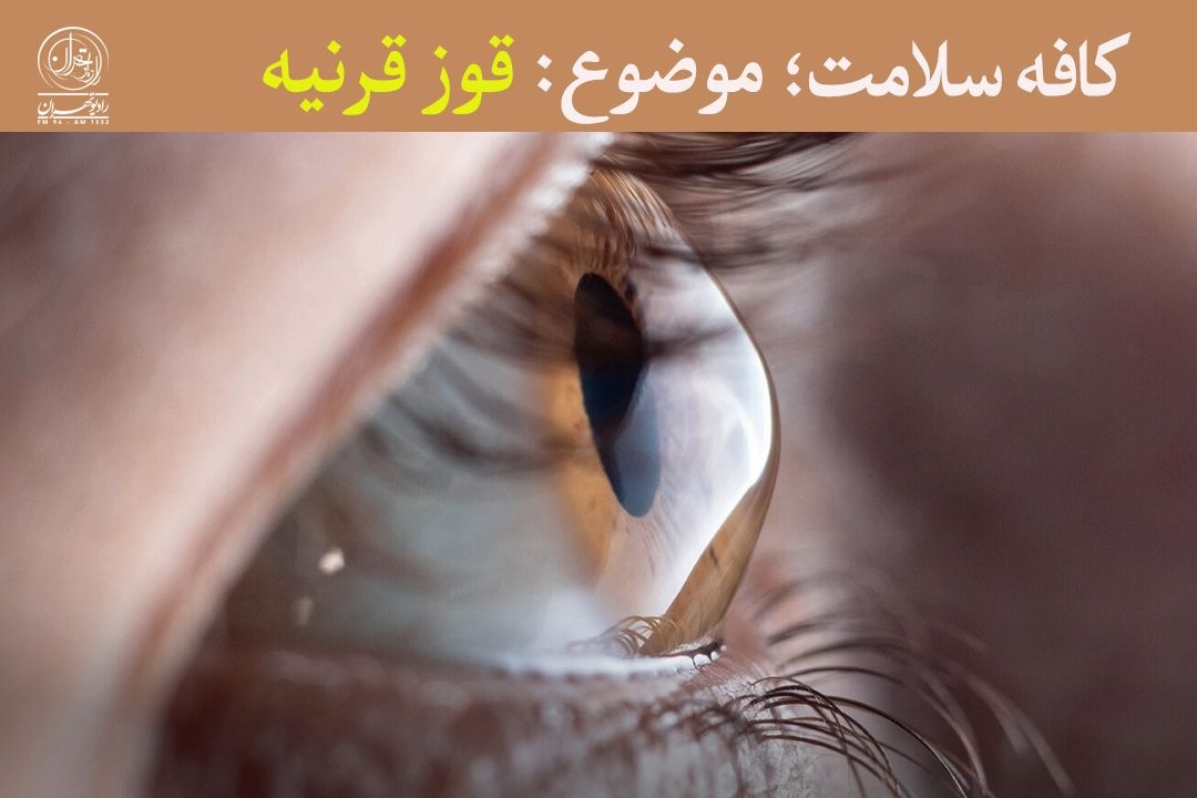 مالیدن مستمر چشم‌ها احتمال ابتلا به قوز قرنیه را افزایش می‌دهد