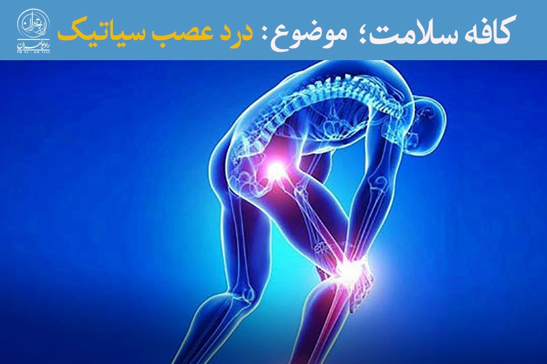 سیاتیك؛ دردی شایع اما قابل پیشگیری