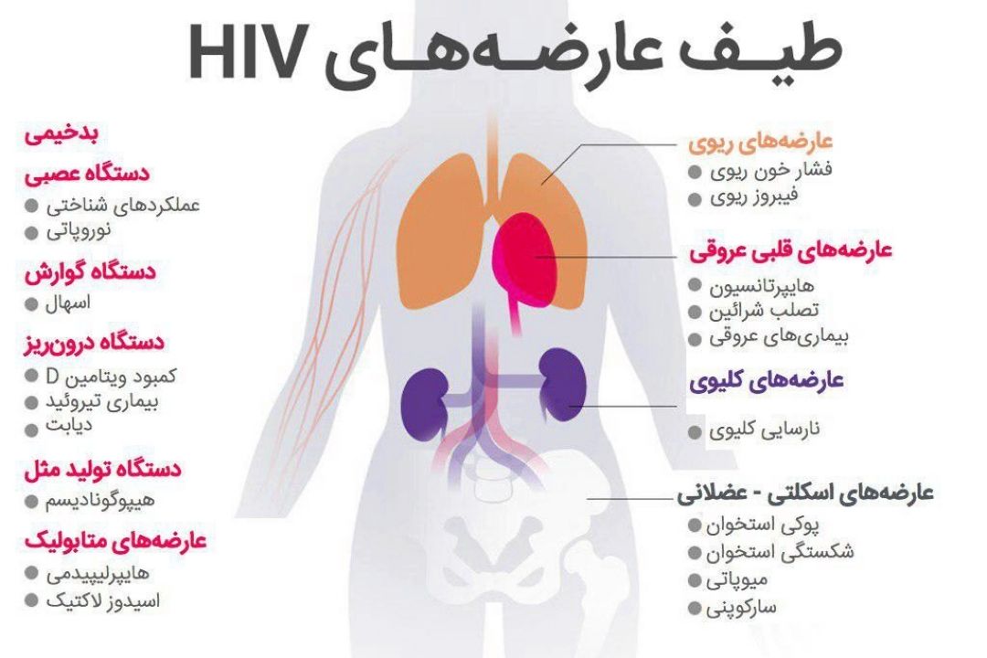 در برنامه نبض جمعه ششم بهمن درباره ایدز صحبت میكنیم.