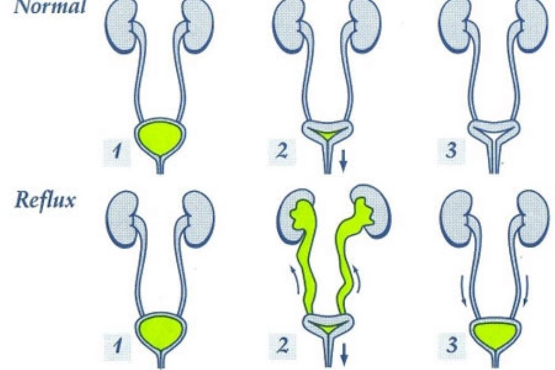 نبض