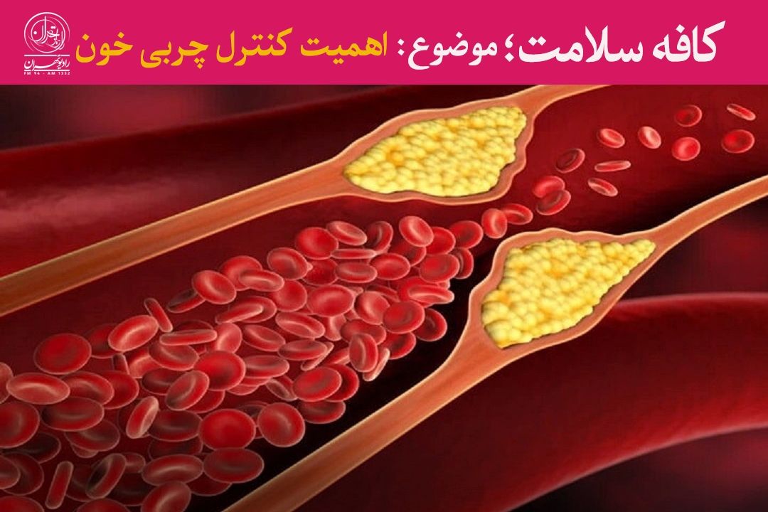 چربی خون بالا، دشمن خاموش قلب و عروق 