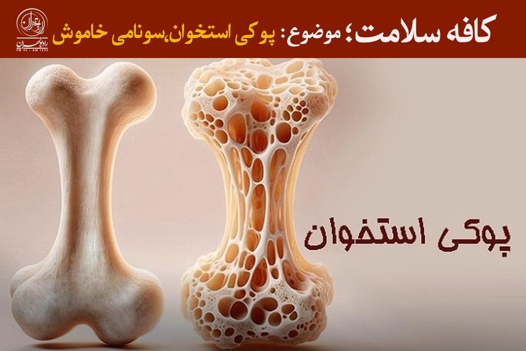 پوكی استخوان؛ سونامی خاموش در كمین سالمندان
