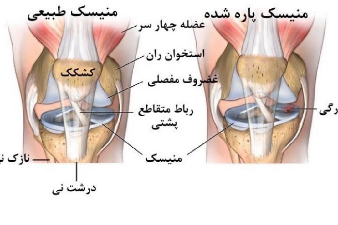 علت لرزش پا بعد از بازی فوتبال