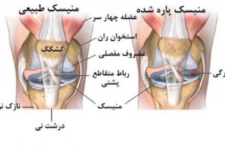 علت لرزش پا بعد از بازی فوتبال