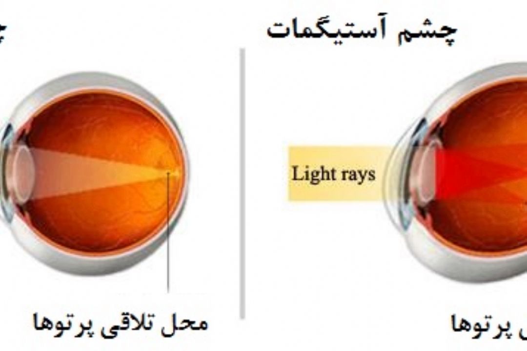 نبض