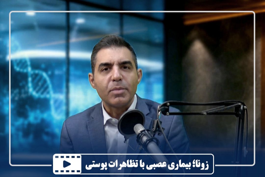 زونا؛ بیماری عصبی با تظاهرات پوستی