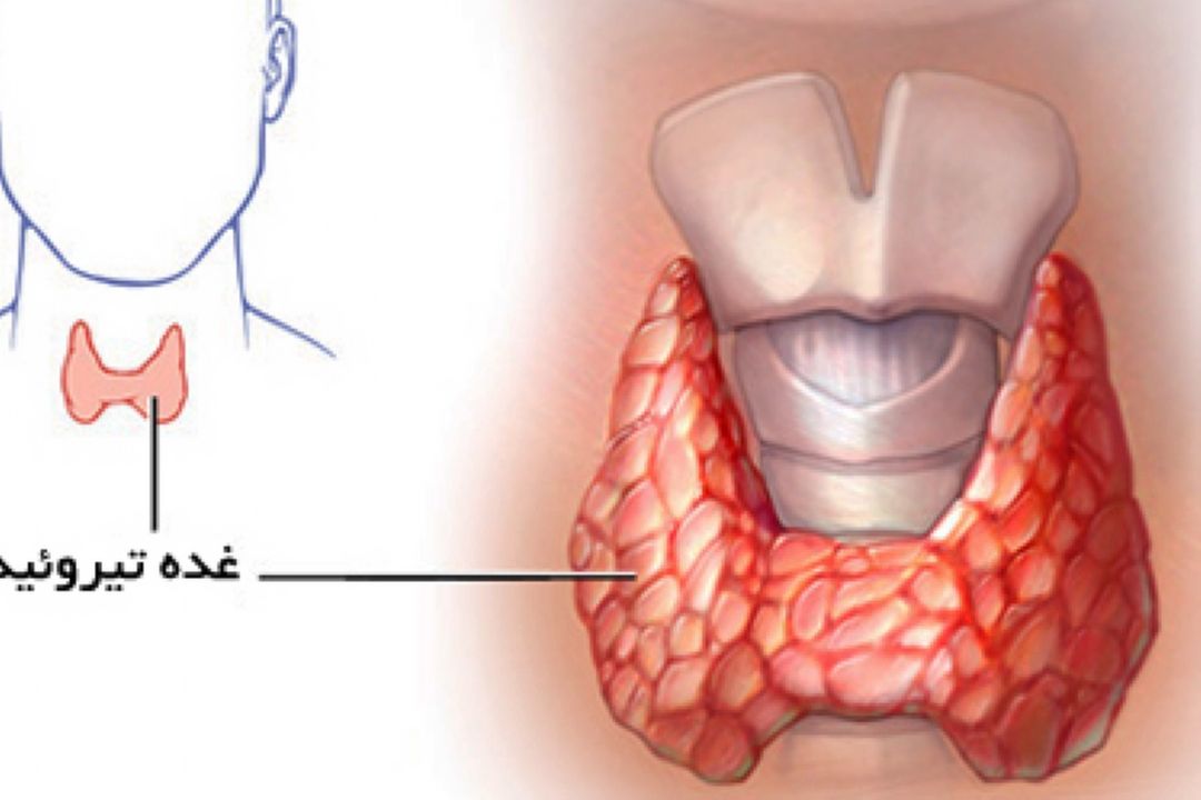 در برنامه نبض یكشنبه بیست و نهم بهمن درباره چاقی و كم كاری تیرویید صحبت میكنیم