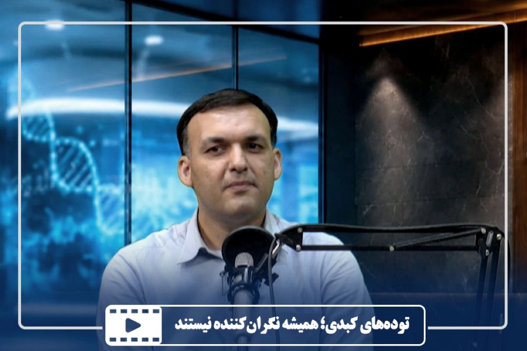 توده‌های كبدی؛ همیشه نگران‌كننده نیستند