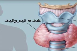 در برنامه نبض یكشنبه ششم اسفند درباره درمان كم كاری تیرویید صحبت میكنیم