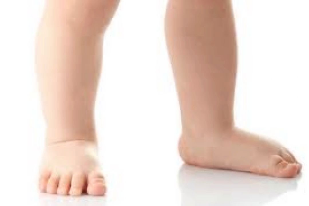 كف پای صاف 