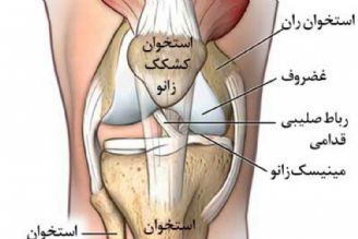 علل درد كشكك زانو و تمرینات اصلاحی 