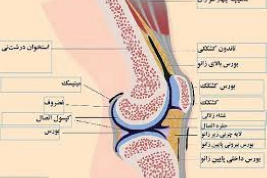 علل درد كشكك زانو هنگام دویدن 