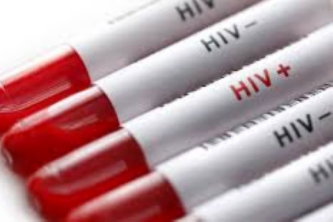 بیماری hiv