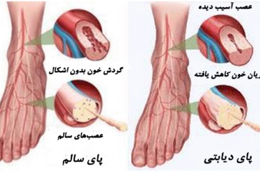 نبض