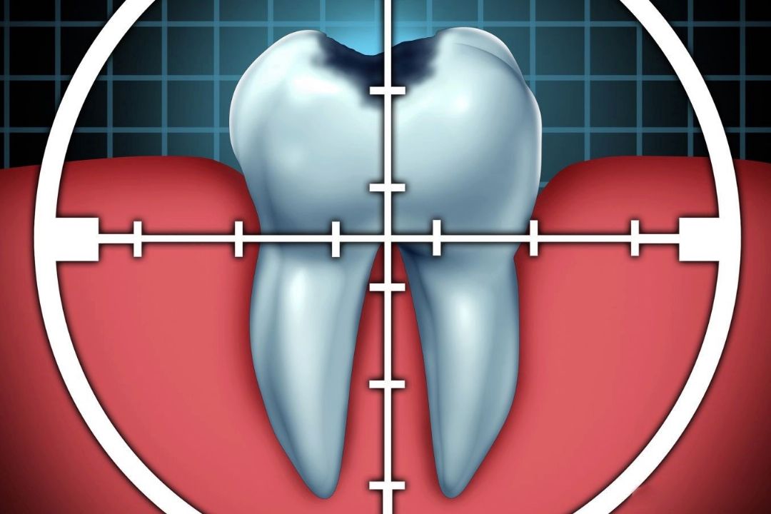 سلامت «دهان و دندان» حلقه گمشده در سلامت عمومی 