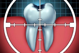 سلامت «دهان و دندان» حلقه گمشده در سلامت عمومی 