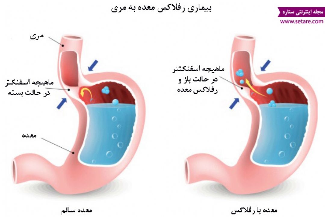 نبض
