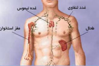 غدد لنفاوی 