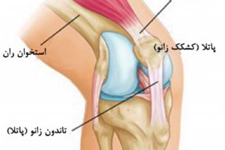 پارگی رباط زانو؛ علائم و روش های درمانی