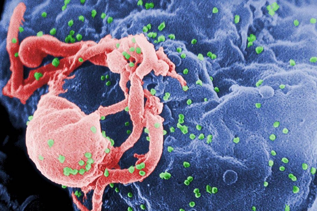 تشخیص رایگان بیماری HIV در مركز بهداشت غرب تهران