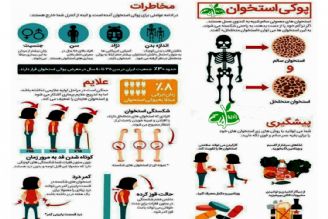 مهمترین علائم پوكی استخوان یا استئوپروز در زنان و مردان