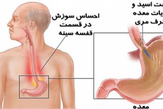 در برنامه نبض دوشنبه هفتم آبان درباره ریفلاكس معده صحبت میكنیم