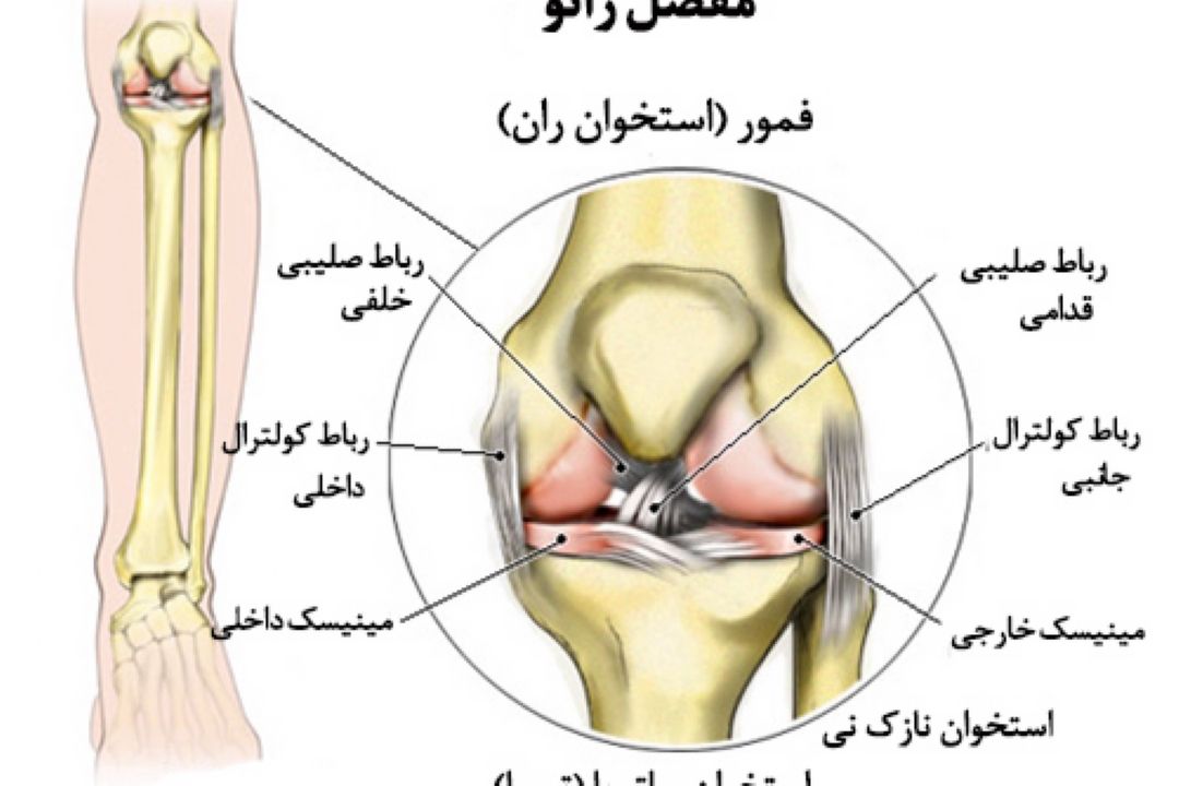 در برنامه نبض دوشنبه پنجم آذر درباره پارگی مینیسك زانو صحبت شد