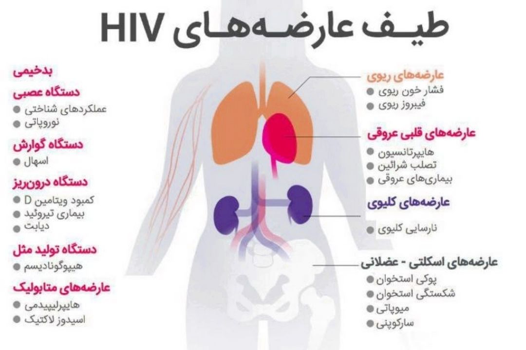 در برنامه نبض جمعه چهاردهم دی درباره ایدز صحبت شد