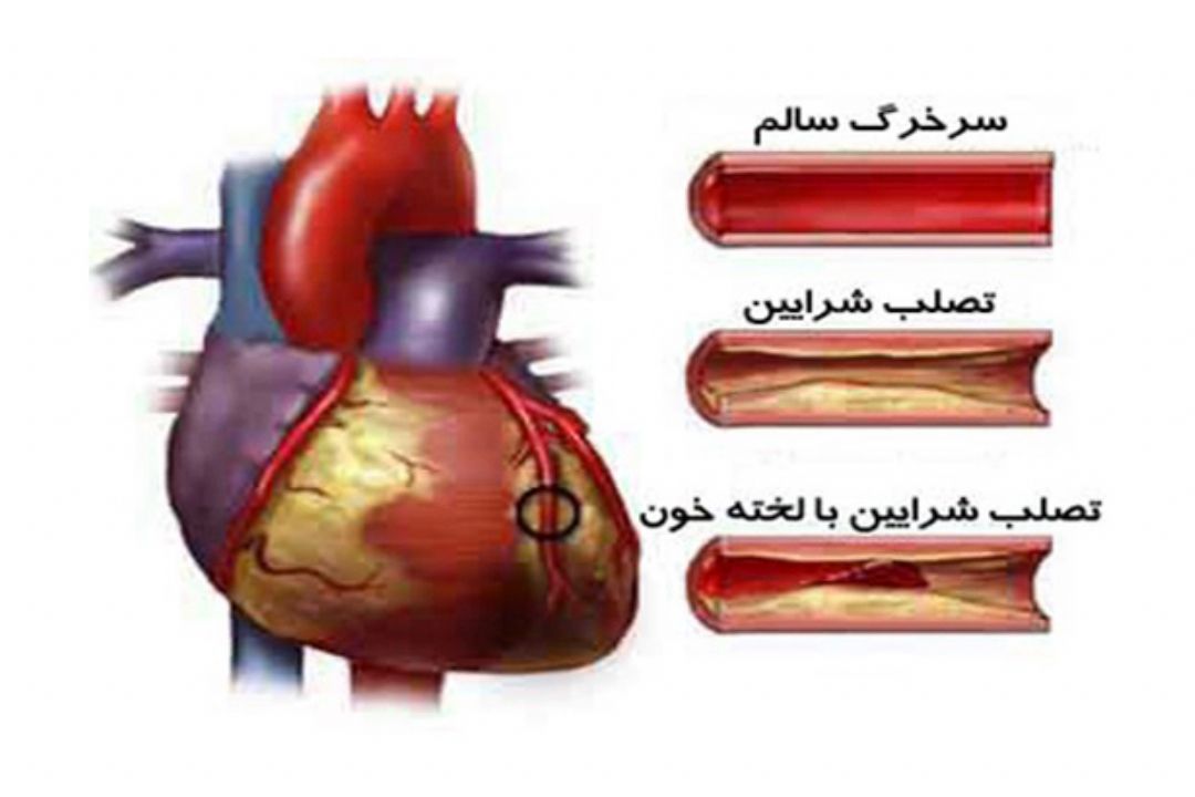 نبض
