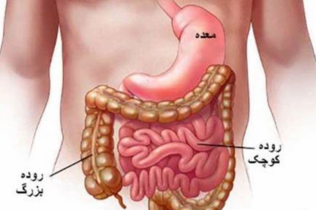 نشانه های سرطان روده بزرگ در تهران كلینیك