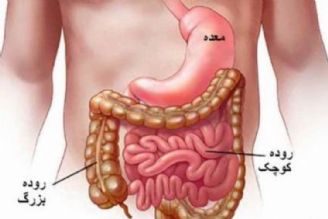 نشانه های سرطان روده بزرگ در تهران كلینیك
