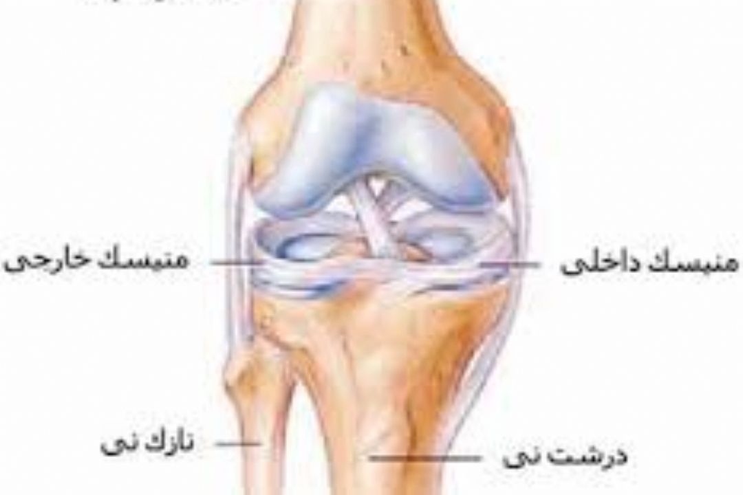 اقداماتی كه بعد از عمل تعویض مفصل زانو باید انجام داد 