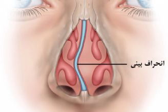 در برنامه نبض یكشنبه دهم شهریور درباره تاثیرات روانی رژیم های لاغری و چاقی و درمان انحراف بینی صحبت شد