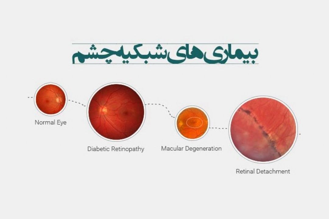 در برنامه نبض شنبه بیست و هفتم مهر درباره مسمومیت با سرب و بیماری مادرزادی شبكیه صحبت شد