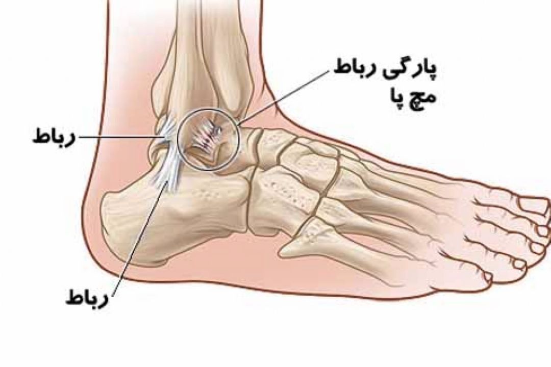 در برنامه نبض سه‌شنبه سوم دی درباره بیماری‌های مثانه و درد مچ پا صحبت شد.