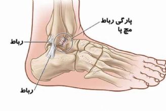 در برنامه نبض سه‌شنبه سوم دی درباره بیماری‌های مثانه و درد مچ پا صحبت شد.