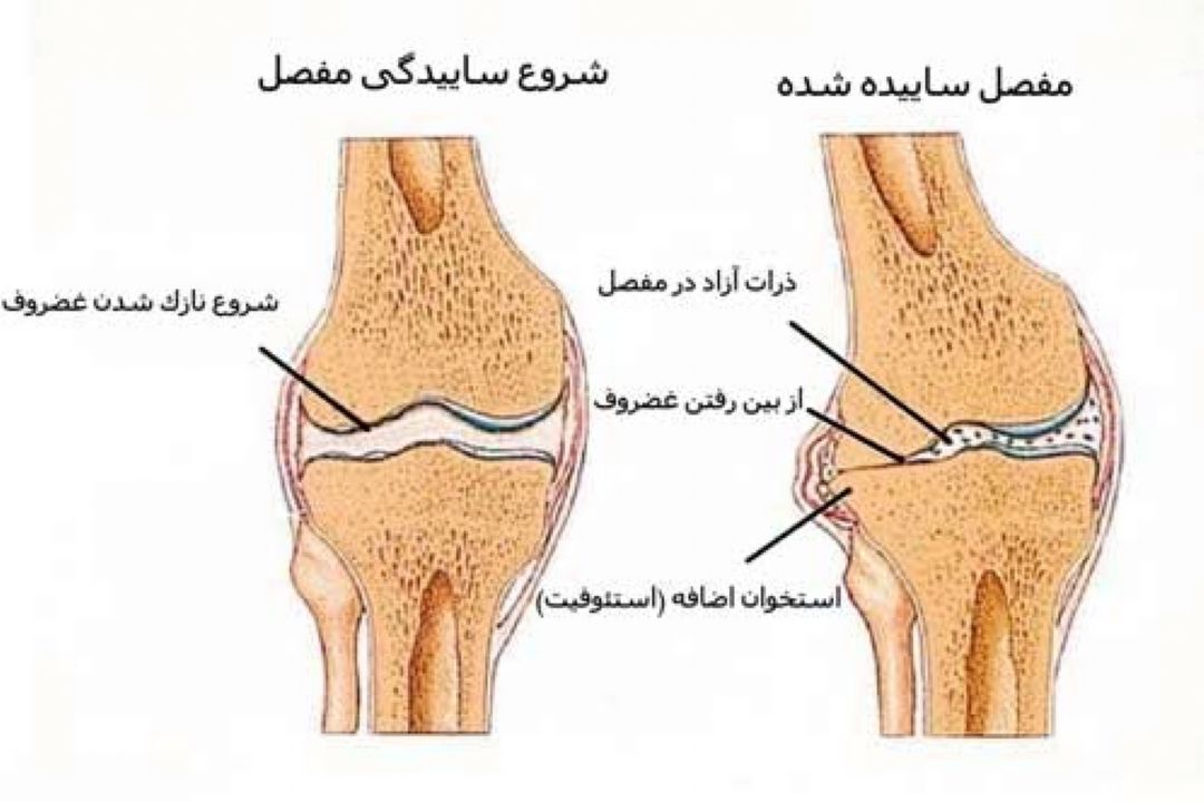 در برنامه نبض دوشنبه 9 دی درباره رابطه آلرژی با بیماری های چشم و ساییدگی زانو صحبت شد